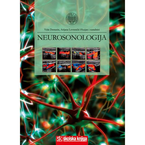  NEUROSONOLOGIJA - Vida Demarin, Arijana Lovrenčić-Huzjan i suradnici slika 1