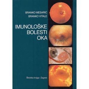  IMUNOLOŠKE BOLESTI OKA - Branko Mesarić, Branko Vitale