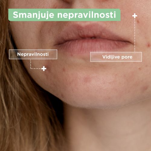 Mixa gel za čišćenje lica protiv ​nepravilnosti  slika 5