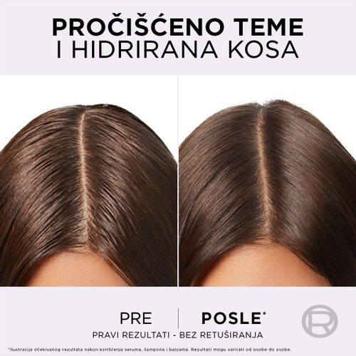 L’Oréal Paris Elseve Hyaluron pure serum za teme koje se brzo masti slika 3