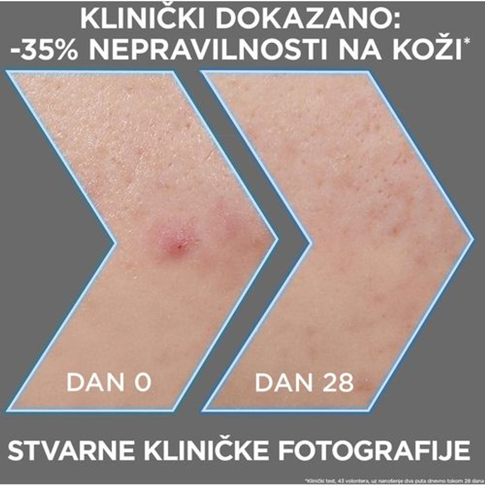 Garnier PureActive serum za lice AHA + BHA Charcoal 30ml slika 4