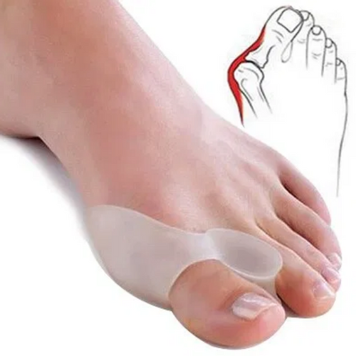 Hallux valgus, čukljevi – valgomed, anatomski štitnici slika 3