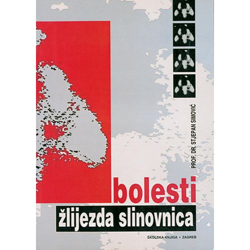  BOLESTI ŽLIJEZDA SLINOVNICA - Stjepan Simović slika 1