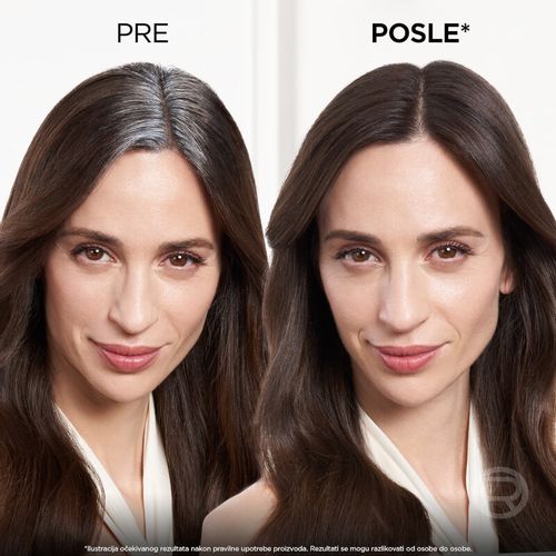 L'Oreal Paris Magic Retouch sprej za privremeno prikrivanje izrastka Brown 3 75ml slika 4