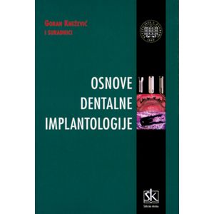  OSNOVE DENTALNE IMPLANTOLOGIJE - Goran Knežević i suradnici