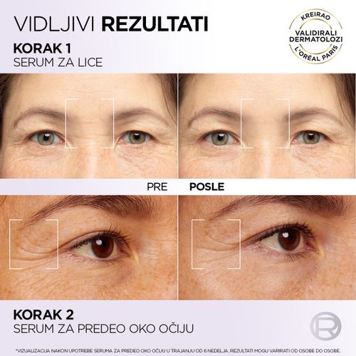 L'Oreal Paris Revitalift Filler serum za ispod očiju 20ml slika 6