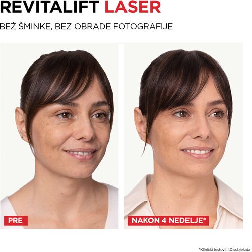L'Oréal Paris Revitalift Laser dnevna krema protiv bora 50ml slika 8