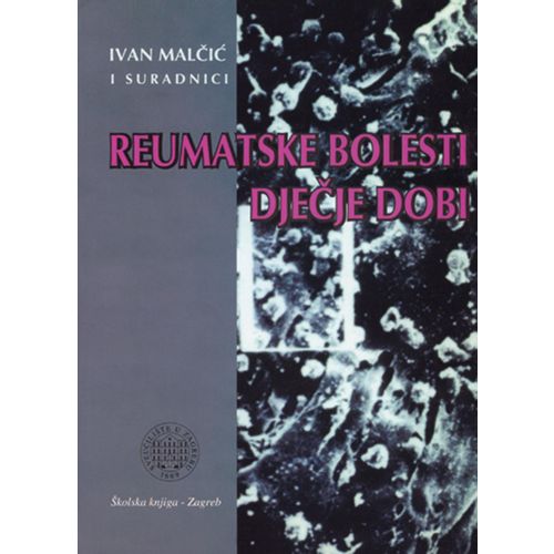  REUMATSKE BOLESTI DJEČJE DOBI - Ivan Malčić slika 1