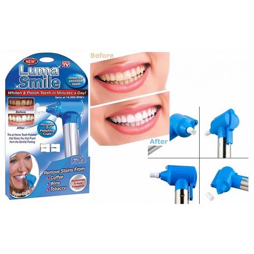 Aparat za poliranje i izbeljivanje zuba - Luma Smile slika 1