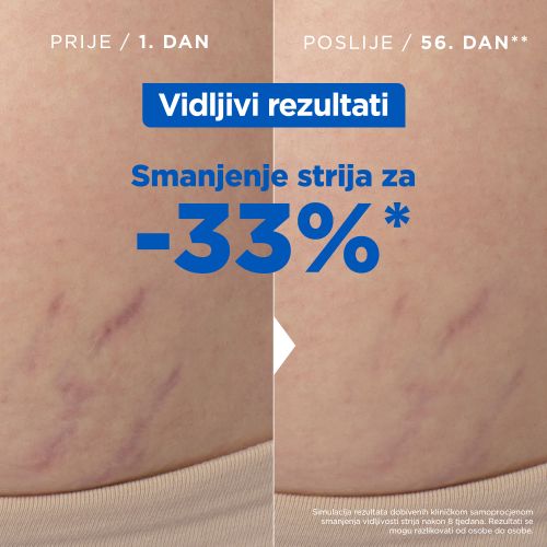 Mixa Ulje protiv strija 50ml​ slika 5