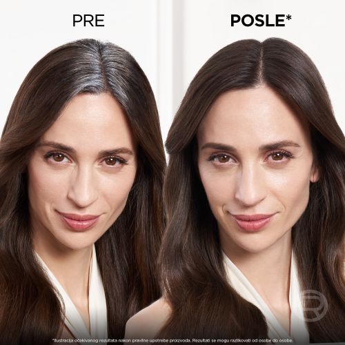 L'Oreal Paris Magic Retouch sprej za privremeno prikrivanje izrastka Black 1 75ml slika 4