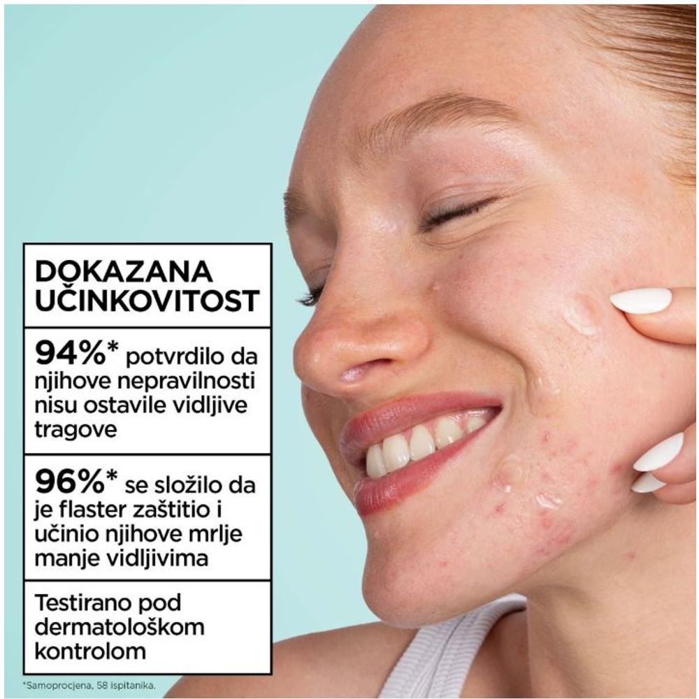 Garnier Flasteri za bubuljice Pure Active Ultra flasteri , 22 kom. slika 8