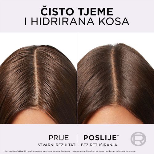 Elseve Hyaluron Pure pročišćavajući serum za vlasište 102 ml slika 3