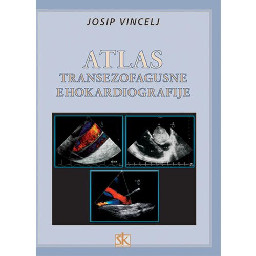  ATLAS TRANSEZOFAGUSNE EHOKARDIOGRAFIJE - Josip Vincelj slika 1