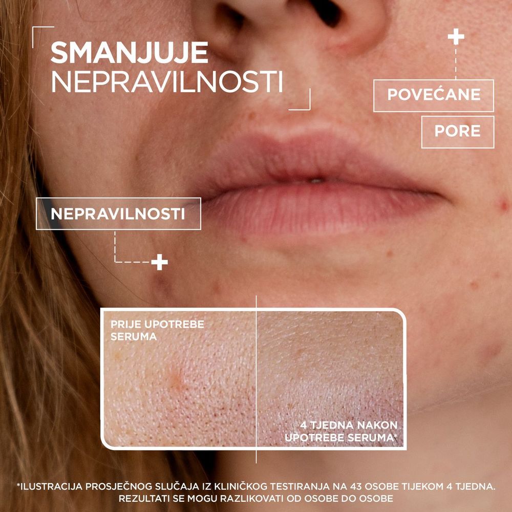 Mixa Anti-Imperfection Serum protiv nepravilnosti 30ml slika 2