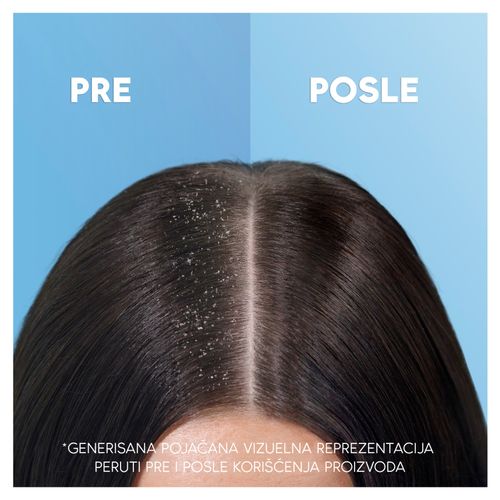 Head&Shoulders šampon za kosu protiv peruti Citrus 330ml slika 3