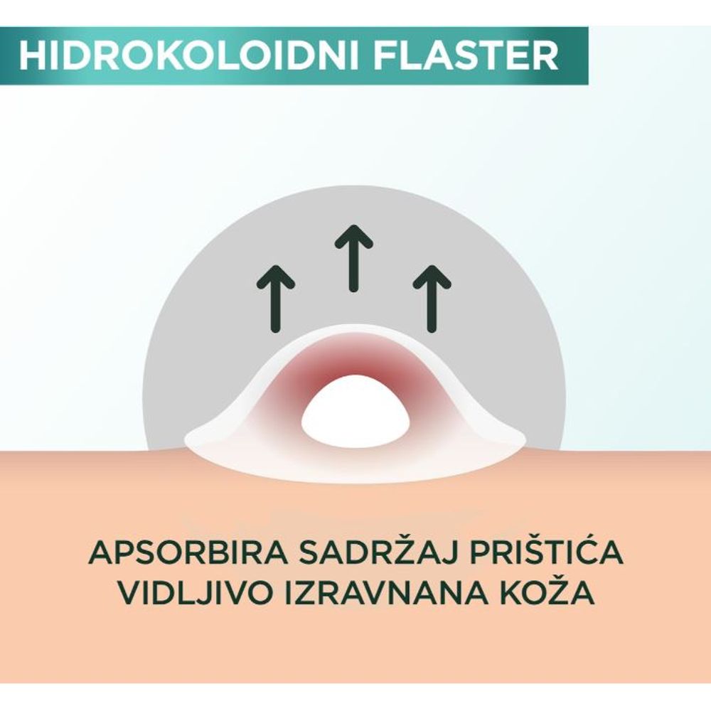 Garnier Pure Active Flaster za bubuljice 22kom slika 7