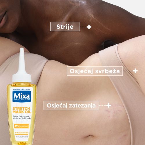 Mixa Ulje protiv strija 50ml​ slika 3