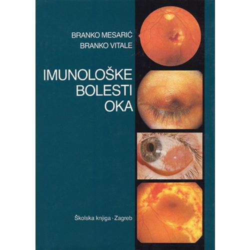  IMUNOLOŠKE BOLESTI OKA - Branko Mesarić, Branko Vitale slika 1