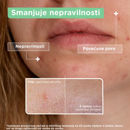 Mixa Anti- Imperfection serum protiv nepravilnosti 30ml slika 4