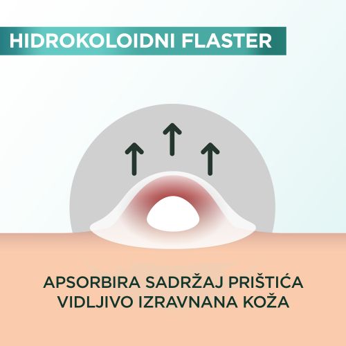 Garnier Pure Active flaster za prištiće slika 4