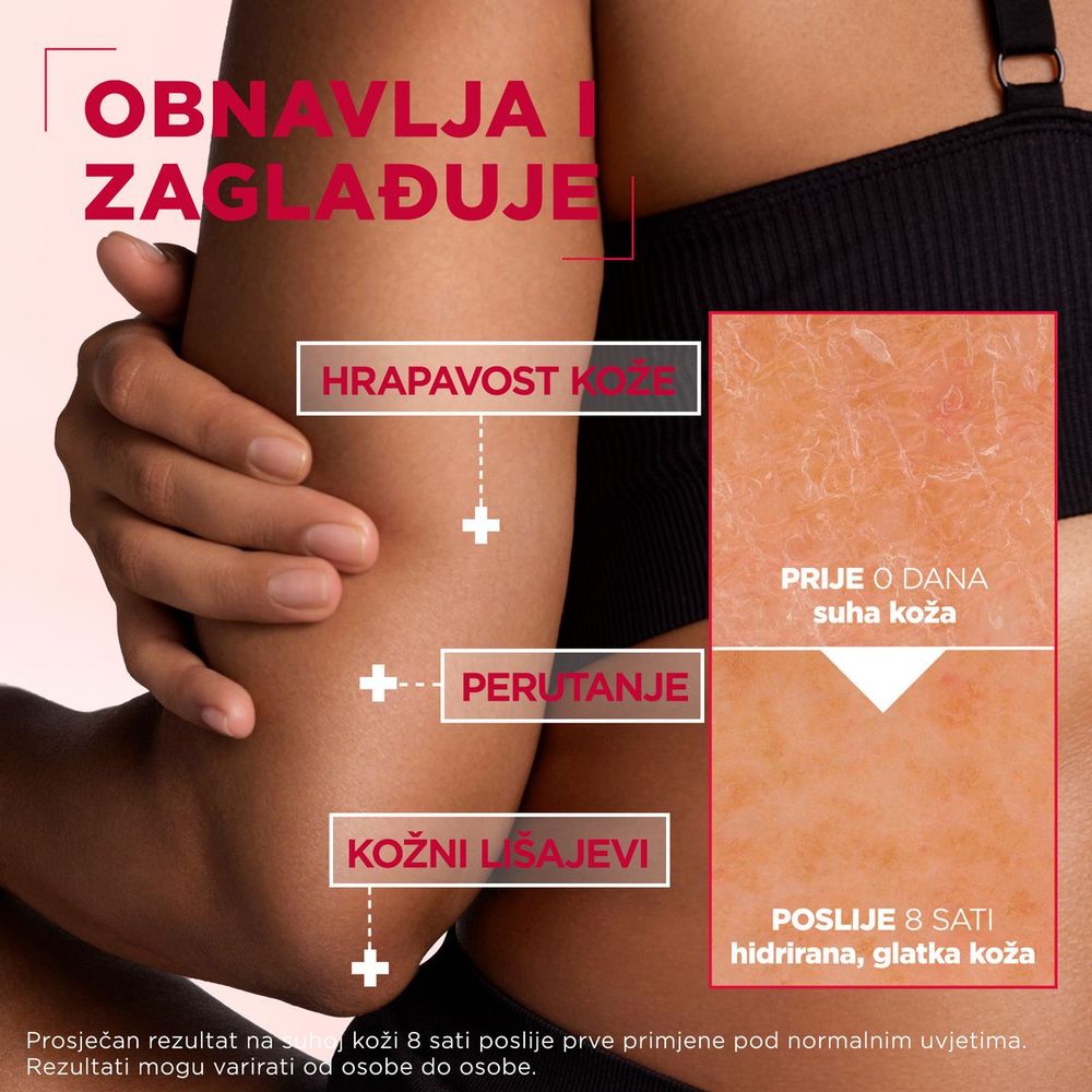 Mixa Urea Cica Repair Obnavljajuća krema za suhu kožu 400ml slika 4