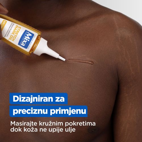 Mixa Ulje protiv strija 50ml​ slika 7