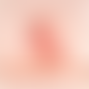 Vibrator Bloom